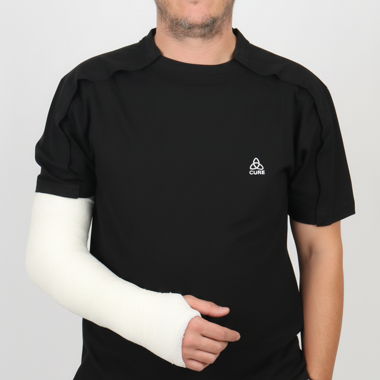 How to Dress with a Broken Arm? Practical Solutions and Tips